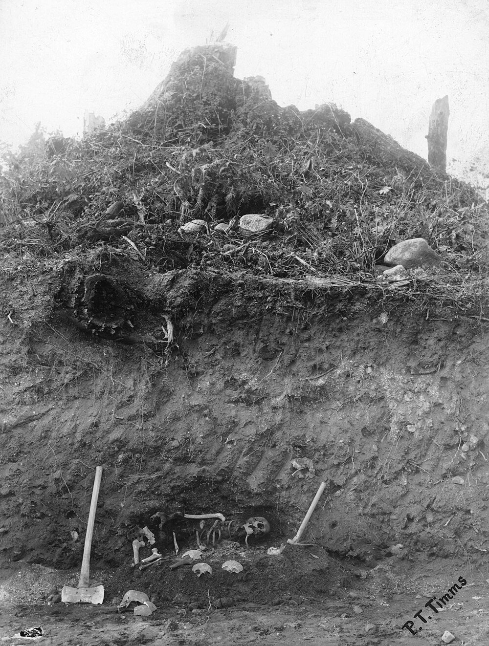 Excavation of human skeleton beneath mound Archaeological excavation revealing human skeleton and bones beneath a mound with excavation tools nearby